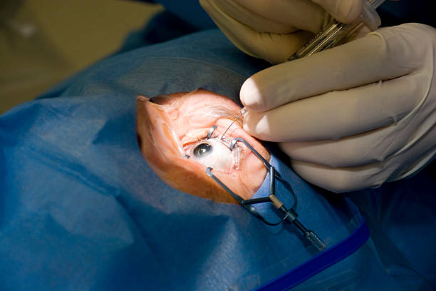 close-up of surgeons hands performing manual eye surgery - cataract surgery stock pictures, royalty-free photos & images