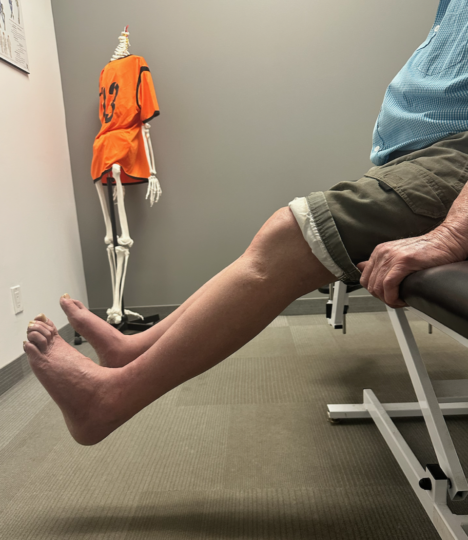 EPISODE 1061   	ACUPUNCTURE